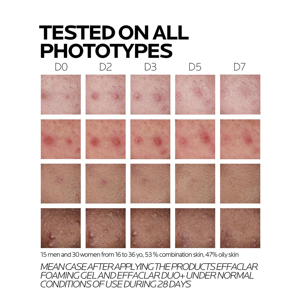 lrp-effaclar-duo-M-pdp-Diversity